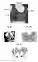 Fig. 72 - Method for patch placement and articles produced