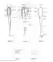 Fig. 03 - Powder Dispensing Device