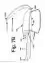 Fig. 05 - Powder Dispensing Device