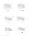 Fig. 04 - A method of mechanically operated scouring abrasion and a mechanically operated scouring abrasion head