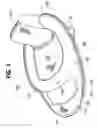 Fig. 02 - Collapsible flotation device
