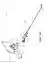 Fig. 03 - Handheld endoscope
