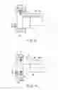 Fig. 10 - Insertion device treatment system