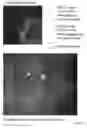 Fig. 03 - System And Method For Real-Time Eye Tracking For A Scanning Laser Ophthalmoscope