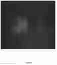 Fig. 09 - System And Method For Real-Time Eye Tracking For A Scanning Laser Ophthalmoscope