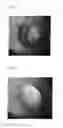 Fig. 06 - APPARATUS FOR DETERMINING AND QUANTIFYING THE STAINING OF OCULAR STRUCTURES AND METHOD THEREFOR