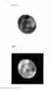 Fig. 07 - APPARATUS FOR DETERMINING AND QUANTIFYING THE STAINING OF OCULAR STRUCTURES AND METHOD THEREFOR