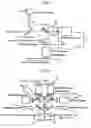 Fig. 04 - Removable Optical Coherence Tomography (OCT) device