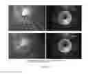 Fig. 16 - Devices and methods for noninvasive measurement of intracranial pressure