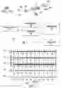 Fig. 03 - System and method of extraction, identification, marking and display of heart valve signals