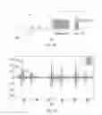 Fig. 07 - System and method of extraction of the heart valve signals