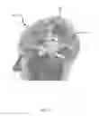 Fig. 06 - Method, system and apparatus for tracking cortical stimulator locations