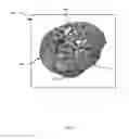Fig. 07 - Method, system and apparatus for tracking cortical stimulator locations