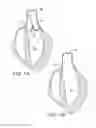 Fig. 02 - Device for measuring an aortic valve annulus in an expanded condition