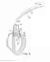 Fig. 06 - Device for measuring an aortic valve annulus in an expanded condition