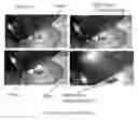 Fig. 06 - Method for Extracting Fluids from Tissue and Uses Thereof