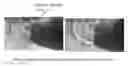 Fig. 07 - Method for Extracting Fluids from Tissue and Uses Thereof