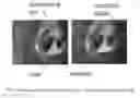 Fig. 08 - Method for Extracting Fluids from Tissue and Uses Thereof