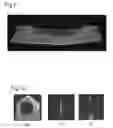 Fig. 08 - Medical needle and puncture tool