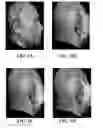 Fig. 02 - Side face image-based mental state determination