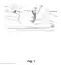 Fig. 08 - Device to detect and treat Apneas and Hypopnea