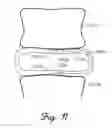 Fig. 14 - SYSTEMS, METHODS, AND DEVICES USING STRETCHABLE OR FLEXIBLE ELECTRONICS FOR MEDICAL APPLICATIONS