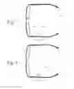 Fig. 03 - EEG glasses (electroencephalographic eyewear)