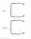 Fig. 05 - EEG glasses (electroencephalographic eyewear)