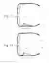 Fig. 08 - EEG glasses (electroencephalographic eyewear)