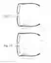 Fig. 09 - EEG glasses (electroencephalographic eyewear)
