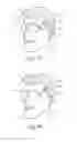 Fig. 19 - EEG glasses (electroencephalographic eyewear)