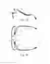 Fig. 24 - EEG glasses (electroencephalographic eyewear)