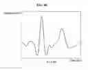 Fig. 07 - Electrocardiogram (ECG) authentication method and apparatus