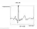 Fig. 13 - Electrocardiogram (ECG) authentication method and apparatus