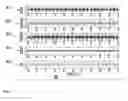 Fig. 04 - SYSTEM AND METHOD OF MEASURING HEMODYNAMIC PARAMETERS FROM THE HEART VALVE SIGNAL