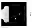 Fig. 16 - HIGH QUALITY CLOSED-LOOP ULTRASOUND IMAGING SYSTEM