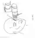 Fig. 27 - Systems and methods for detecting neurological conditions