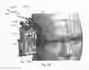 Fig. 52 - Systems and methods for detecting neurological conditions