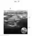 Fig. 17 - Providing user interface in ultrasound system