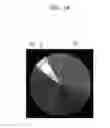 Fig. 18 - Providing user interface in ultrasound system