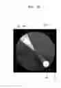 Fig. 20 - Providing user interface in ultrasound system