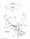 Fig. 02 - Minimally invasive heart stabilizer