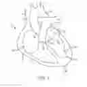 Fig. 02 - SURGICAL CLOSURE CONFIGURATIONS