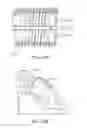 Fig. 128 - SURGICAL CLOSURE CONFIGURATIONS