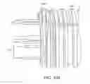 Fig. 129 - SURGICAL CLOSURE CONFIGURATIONS