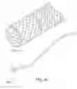 Fig. 134 - SURGICAL CLOSURE CONFIGURATIONS