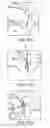 Fig. 136 - SURGICAL CLOSURE CONFIGURATIONS