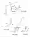 Fig. 147 - SURGICAL CLOSURE CONFIGURATIONS