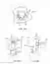 Fig. 149 - SURGICAL CLOSURE CONFIGURATIONS