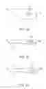 Fig. 31 - SURGICAL CLOSURE CONFIGURATIONS